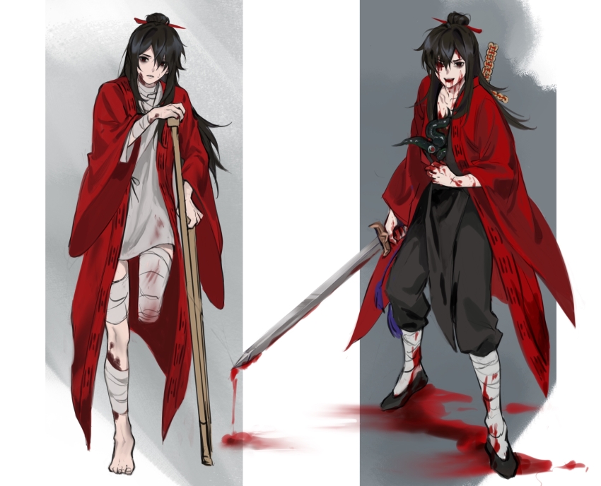 2boys, absurdres, amputee, bandaged_arm, bandaged_leg, bandaged_neck, bandages, barefoot