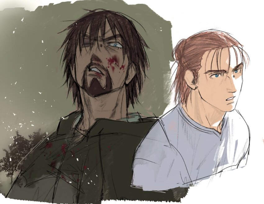 1boy, beard, black_jacket, blood, blood_on_face, blue_eyes, bruise, bruised_eye