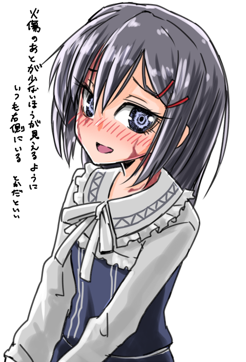 1girl, black_hair, blue_eyes, blush, burn_scar, dorei_to_no_seikatsu_~teaching_feeling~, dress, female_focus